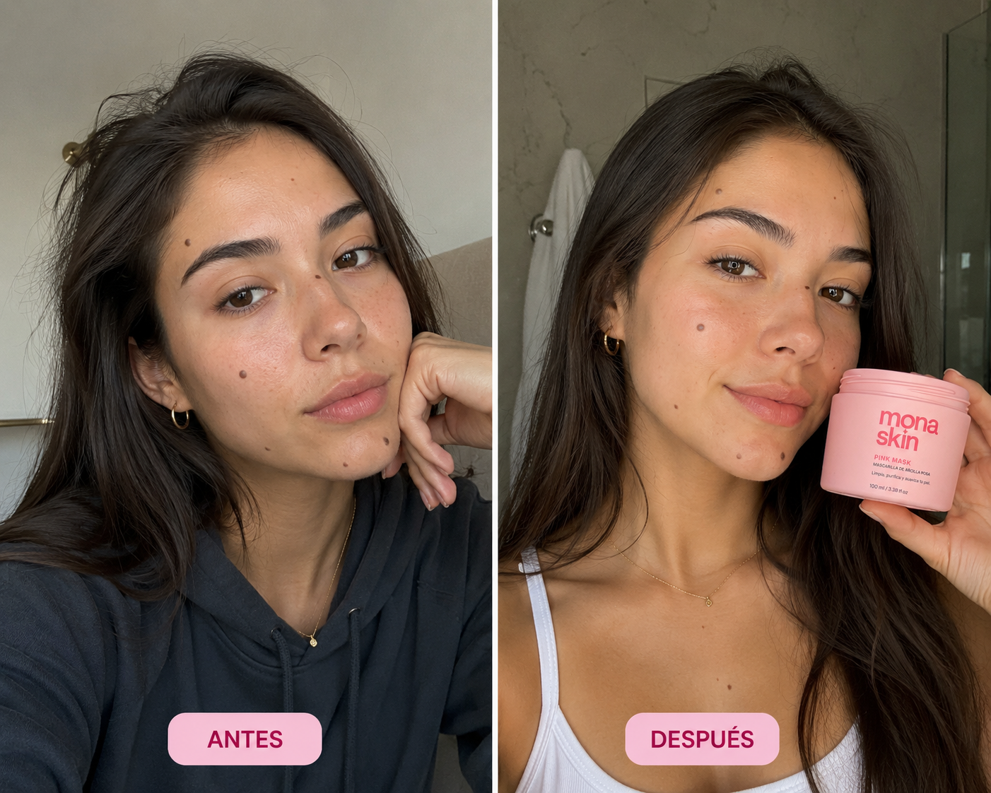 Antes y después — Frida, 20